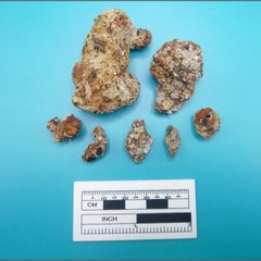 Fragments of ferrous metal next to a ruler for size